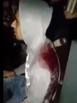 Guy Stabbed in the Back one Last Time by His Girlfriend 