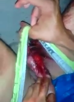 Dudes Nuts RIPPED the Fuck Apart... In Total Shock and Agony