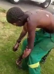 Thief with his skin burned waits for help