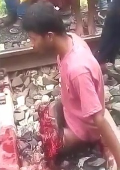 Another Man in Shock After Losing Both His Legs in Train Accident
