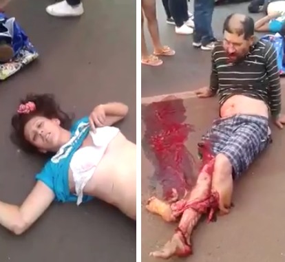 Man Fucked up with Leg Mangled Besides his Dead Wife