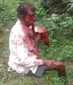 Man in Shock has His Face Literally Skinned From Machete Attack .