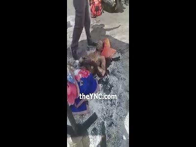 DAYUM!! Guy Still Alive after HORRIFIC Motorcycle Accident