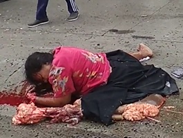 Woman Crushed on Street Still Alive Talking 