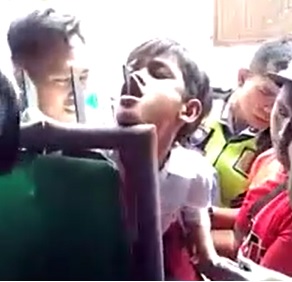 That's a Mouthful: Steel Bar Impaled Through Kids Jaw