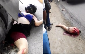 Girl Crushed and Leg Ripped Right Off