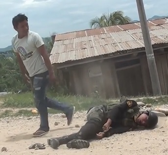 Police Officer Doing the Death Rattle After Taking a Rock to the Head