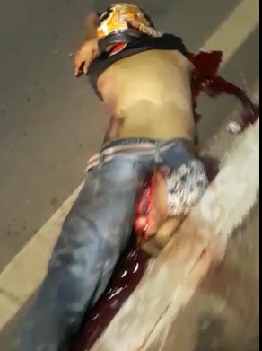 Horrific Motorcycle Accident and Aftermath