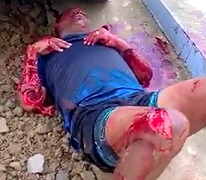 Dude Crying in Total Agony Hacked up by a Machete