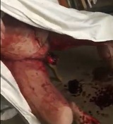 Sick Fuck Amputated His Own Penis and Sliced his Throat 
