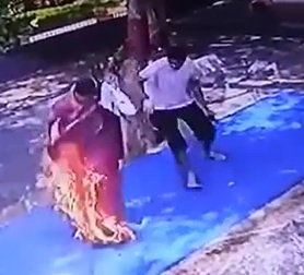 Woman Accidentally Lights Herself on Fire. 