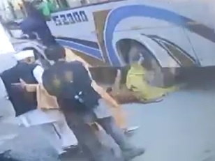 Dudes Leg and Dick Crushed by Bus