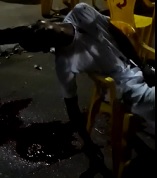 Drip, Drip, Drip .. Blood Pours Out of Murdered Dudes Head