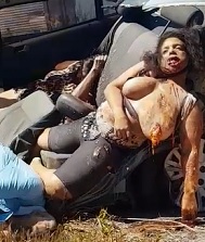 Girl with Hugh Tits Accident Aftermath