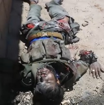 WAR: Mutilated From Mortar Attack (Look at His Hands)