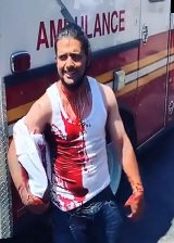 Dude Defending Woman in NYC Stabbed Has Knife Stuck in Head.