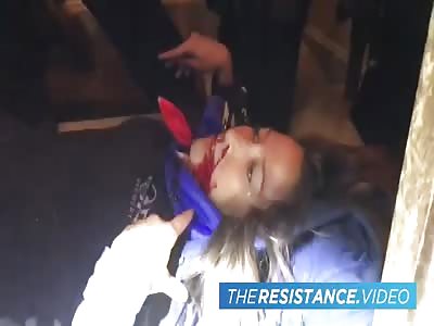 DC Protestor Blown Out Of A Window With A Bullet To The Face 3