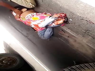Woman with legs blown off by a truck