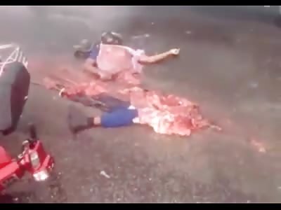 Motorcyclist dismembered in accident