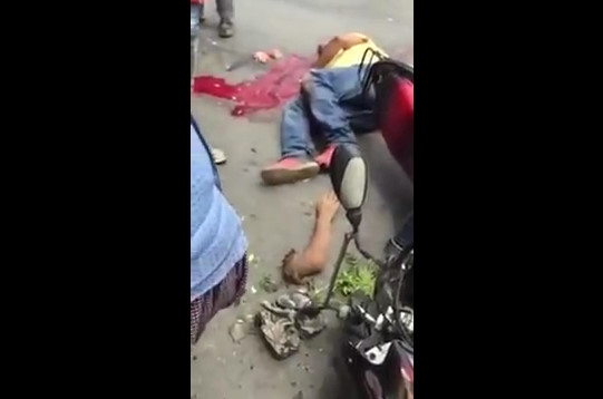 Man Motorcyclist Dead Brain Scattered And The Severed Arm