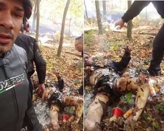 His Friend Burnt in Terrible Agony And He Just Want to Take a Selfie!