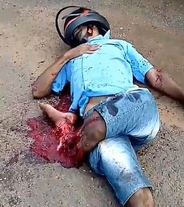 World of PAIN: Terrible Injury to a Motorcyclist Leg after Overturning