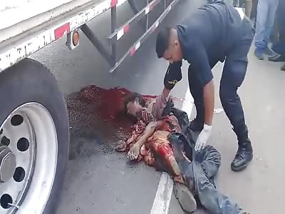 Boy Run over by Something Heavy is Nothing but Guts Now 