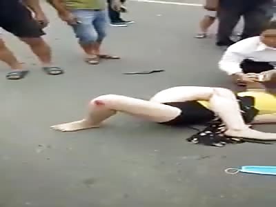 GIRL IN EXTREME AGONY AFTER SUFFERING ACCIDENT