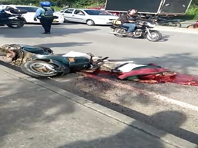MOTORCYCLIST HEAD SMASHED IN AN ACCIDENT