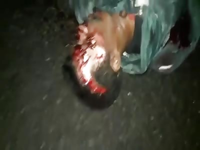 DISTURBING SCENES OF A BLOODY ACCIDENT