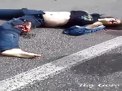 HORRIBLE AFTERMATH OF MOTORCYCLE ACCIDENT