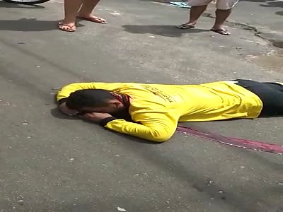 MAN IN YELOW BLED TO DEATH