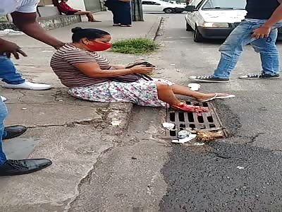 WOMAN FOOT SMASHED IN AN ACCIDENT