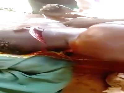 BLACK MAN WITH DEEP WOUNDS CAUSED BY MACHETE