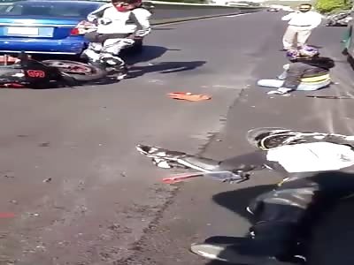SHOCKING AFTERMATH OF MOTORCYCLE ACCIDENT 