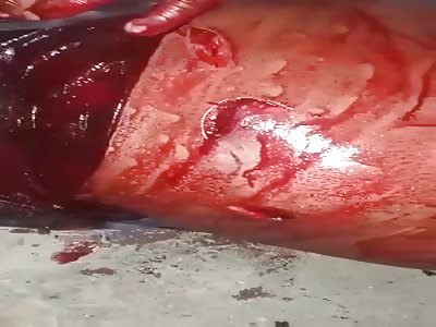 HE WAS HURT WITH KNIFE AND BLEEDS LIKE A PIG IN THE SLAUGHTERHOUSE