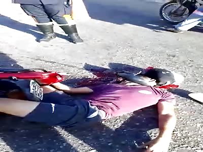 SHORT VIDEO OF MAN'S CRUSHED HEAD IN ACCIDENT