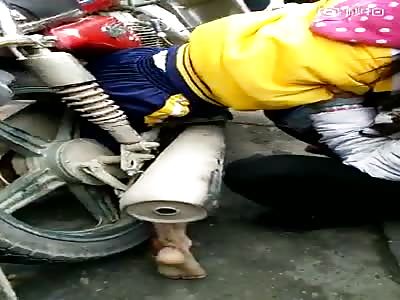  Little girl legs caught by motorbike Wheel.  