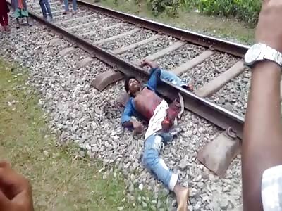 MAN LOSES LEG IN TRAIN ACCIDENT