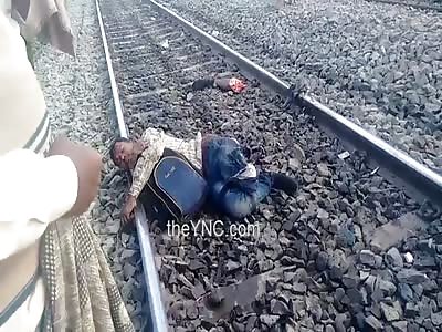 Man Loses Leg By Train