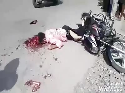 Motorbike Accident.. 