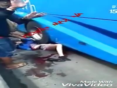 Woman crushed by bus loses her leg