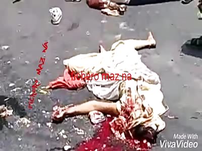 Woman with head fully crushed (best angle)