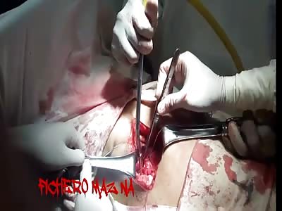 Extraction of stomach worms
