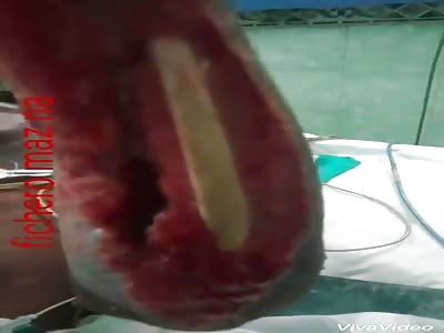 Bacteria eats young arm meat
