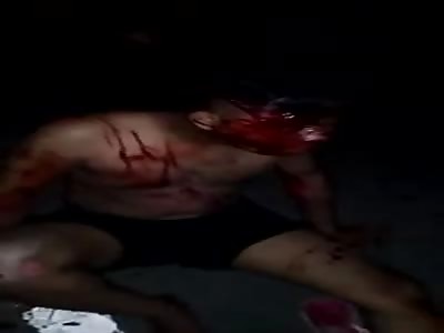Man with Head Bloody after Accident .