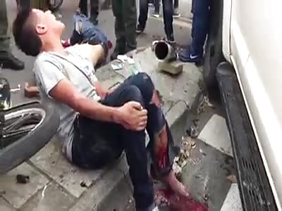 OH HELL..! Man Screaming Pain With Leg Severed In Accident