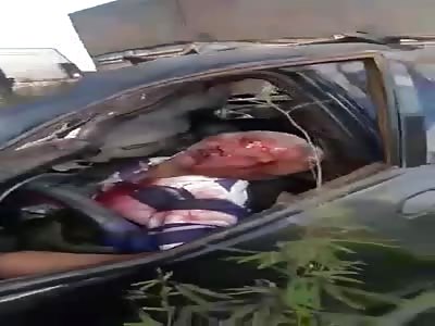 Man`s face disfigured after he was killed by a truck in his vehicle