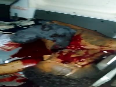Shot in the Head Lays in a Pool of Blood inside a Ambulance 
