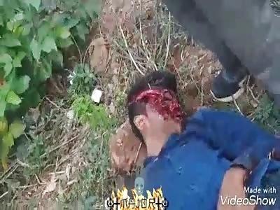 man's Face is Destroyed after accident (still alive)